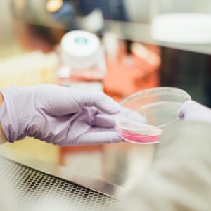 photo petri dish held by someone wearing surgical gloves